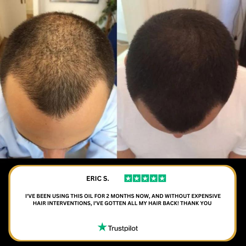 PURE Hair Growth Oil