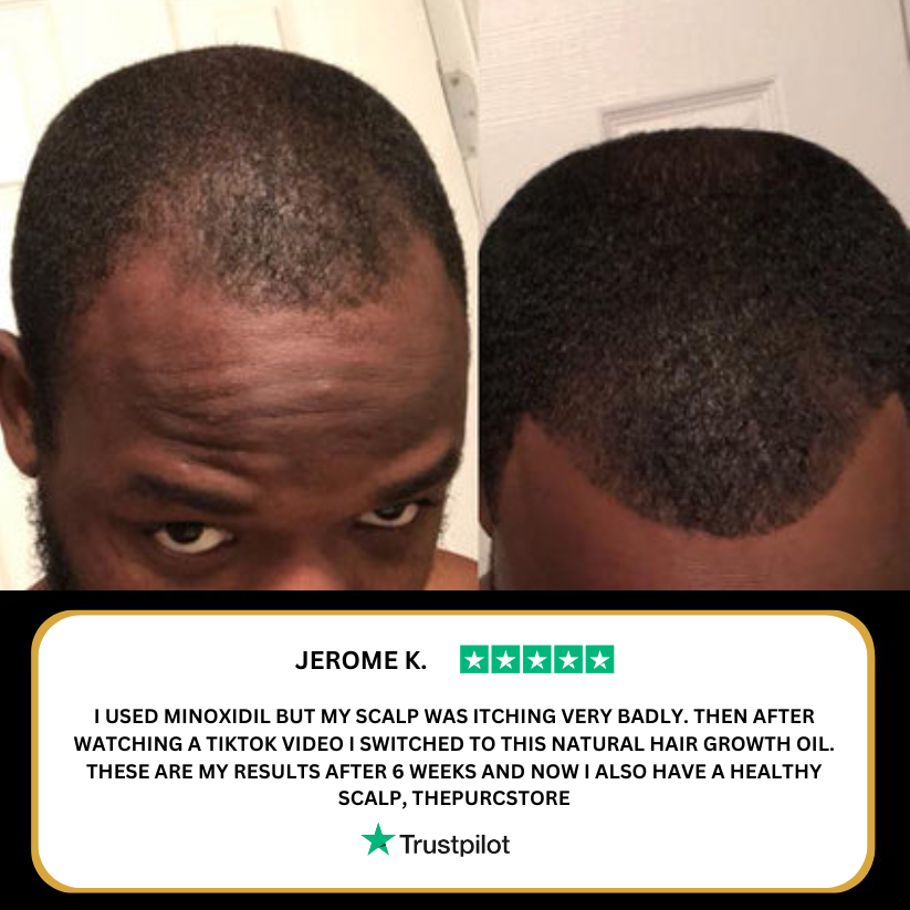 PURE Hair Growth Oil